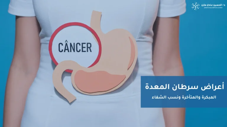 أعراض سرطان المعدة (المبكرة والمتأخرة)