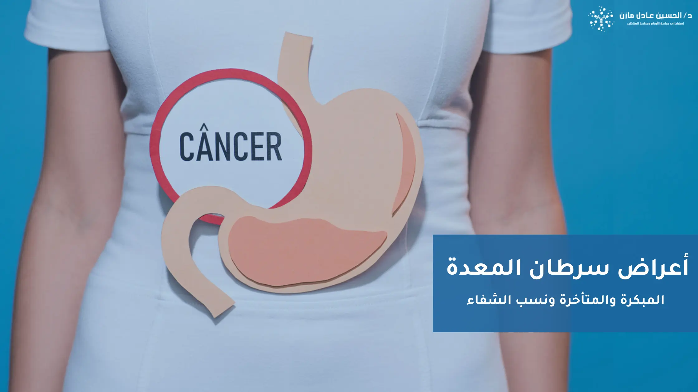 أعراض سرطان المعدة (المبكرة والمتأخرة)