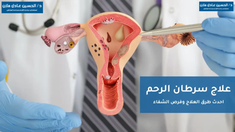 علاج سرطان الرحم
