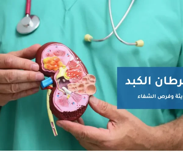 علاج سرطان الكبد