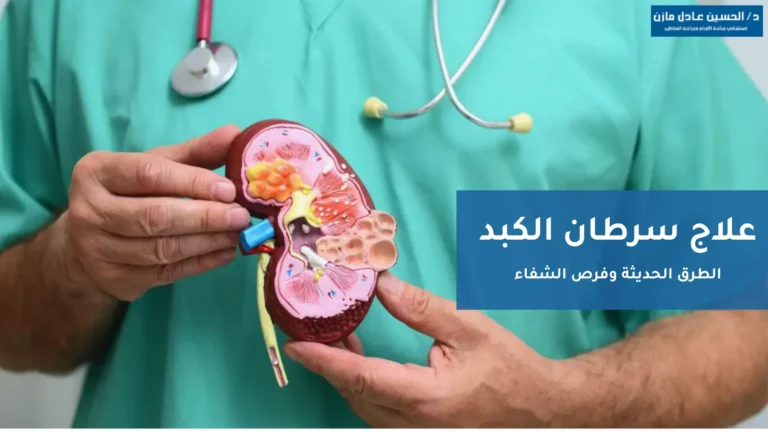 علاج سرطان الكبد